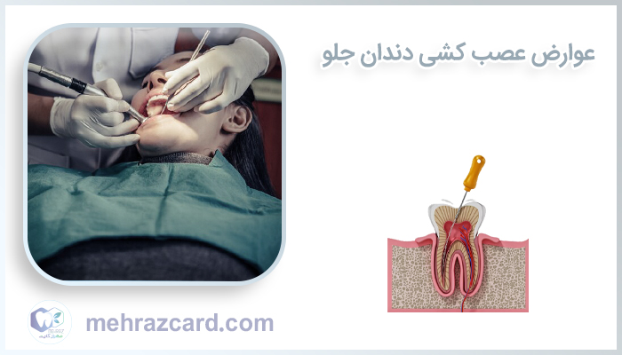 عوارض عصب کشی دندان جلو