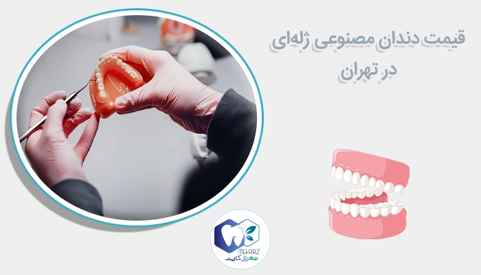 قیمت دندان مصنوعی ژله ای در تهران 
