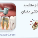 مزایا و معایب عصب کشی دندان