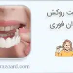 قیمت روکش دندان فوری