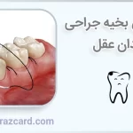 باز شدن بخیه جراحی دندان عقل