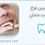 بهترین نوع لمینت دندان