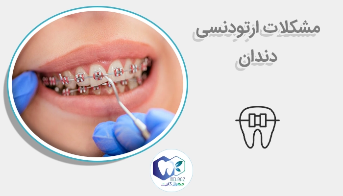مشکلات ارتودنسی دندان