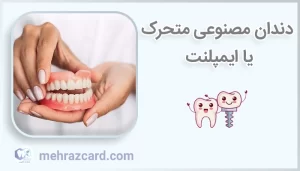 دندان مصنوعی متحرک یا ایمپلنت