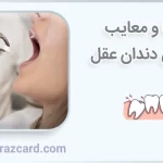 مزایا و معایب کشیدن دندان عقل