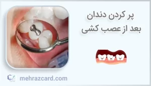 پر کردن دندان بعد از عصب کشی