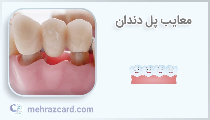 معایب پل دندان