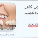 بهترین کشور سازنده لمینت