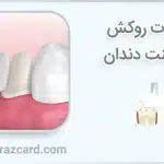 تفاوت روکش و لمینت دندان