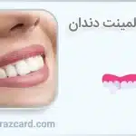 رفع لک لمینت دندان