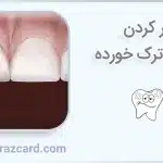 پر کردن دندان ترک ‌خورده