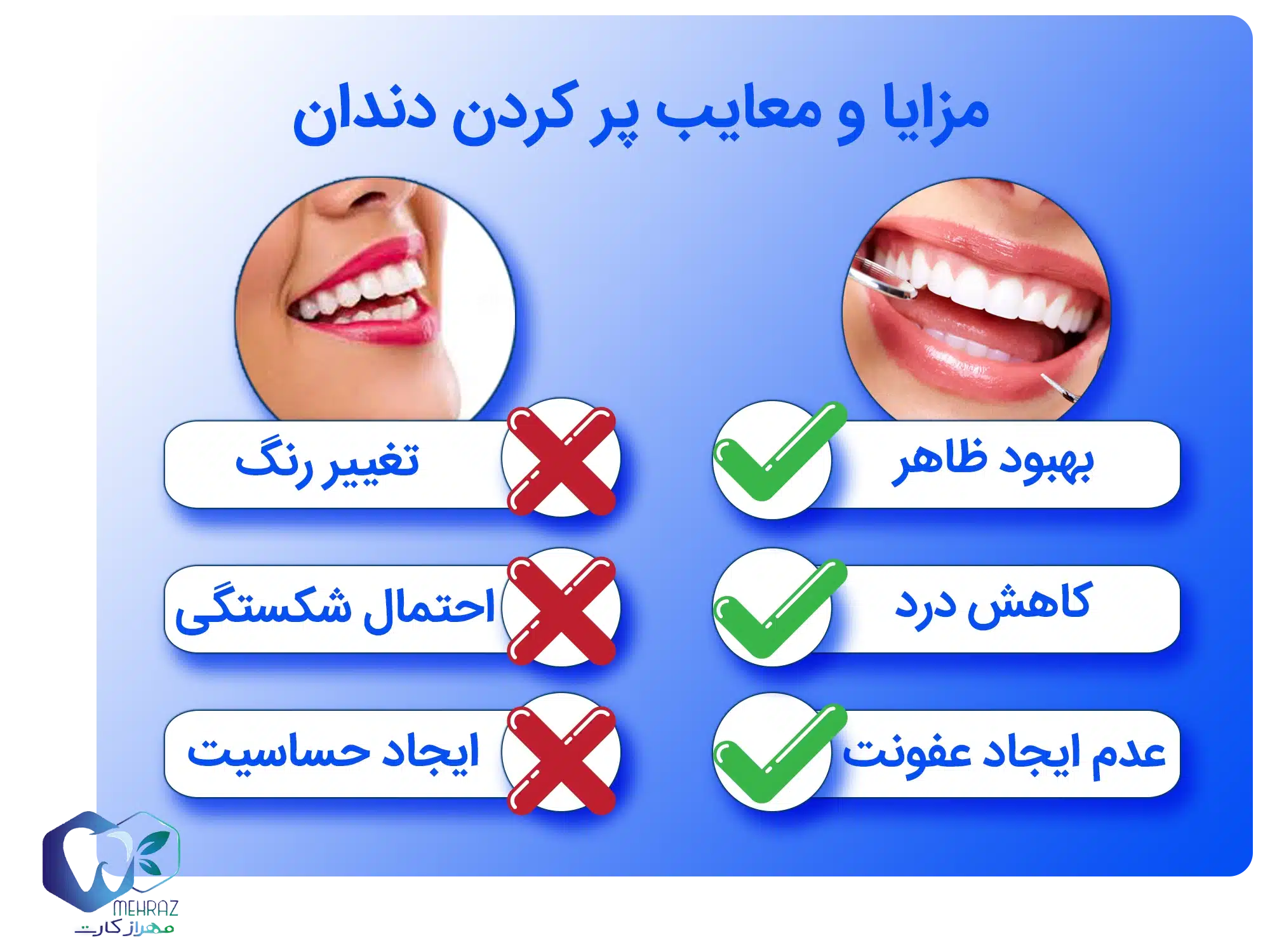 پر کردن دندان