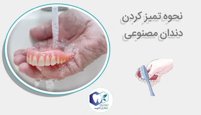 نحوه تمیز کردن دندان مصنوعی