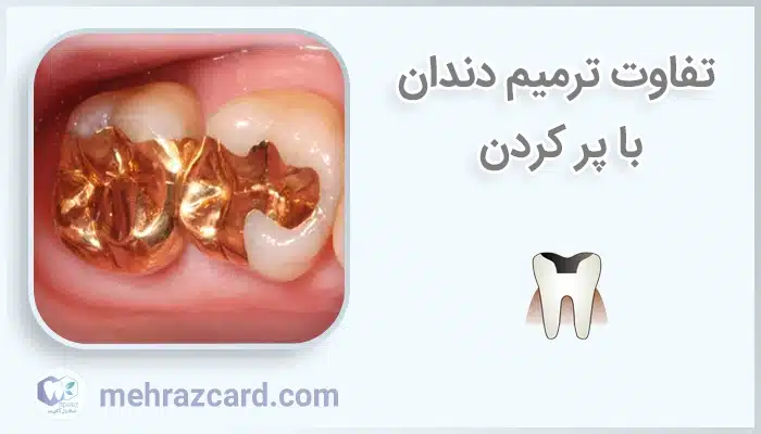 تفاوت ترمیم دندان با پر کردن