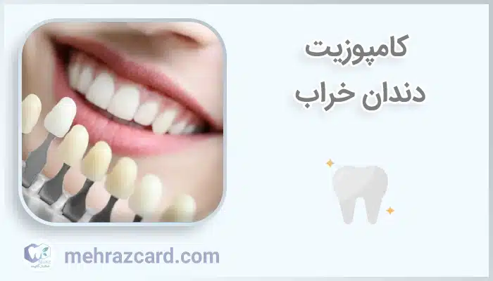 کامپوزیت دندان خراب