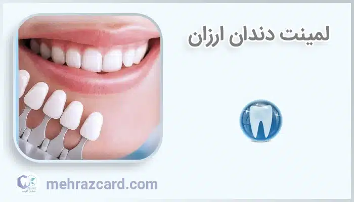 لمینت دندان ارزان