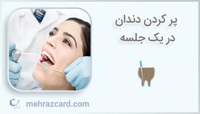 پر کردن دندان در یک جلسه
