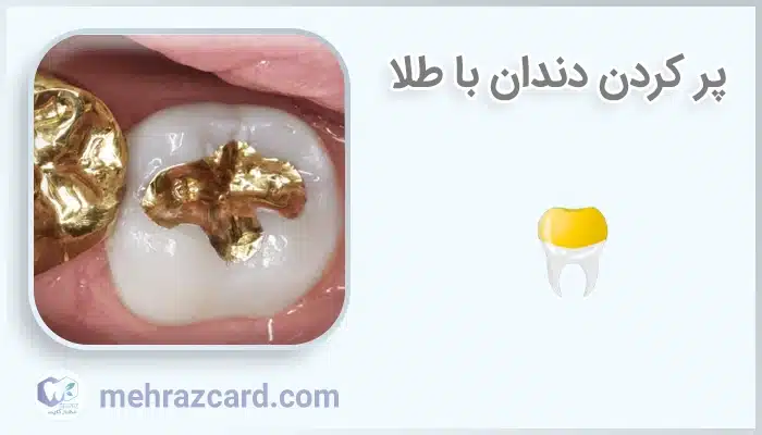 پر کردن دندان با طلا