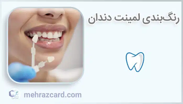رنگ‌بندی لمینت دندان