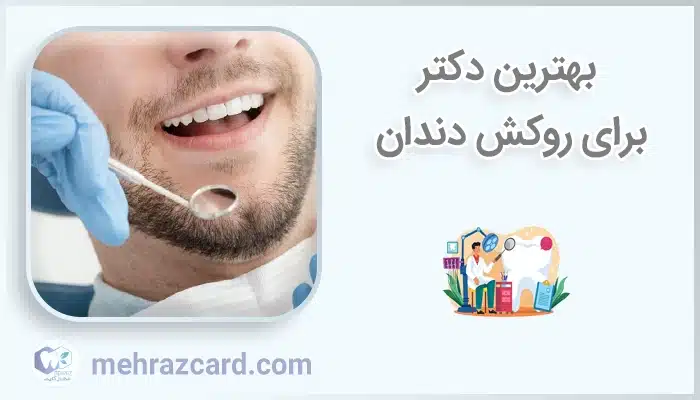 بهترین دکتر برای روکش دندان