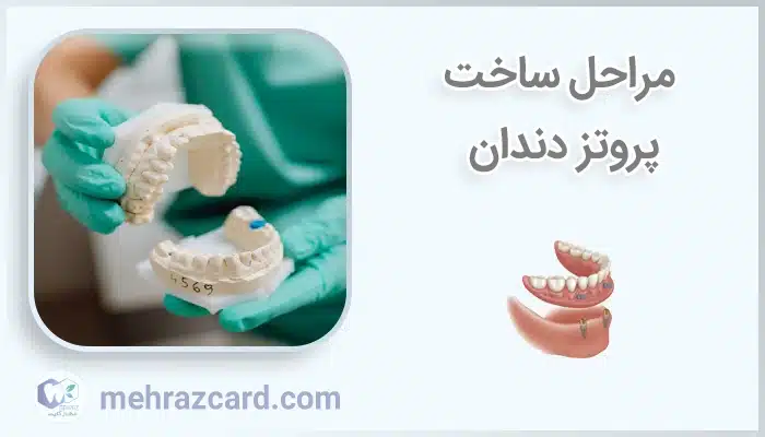 مراحل ساخت پروتز دندان