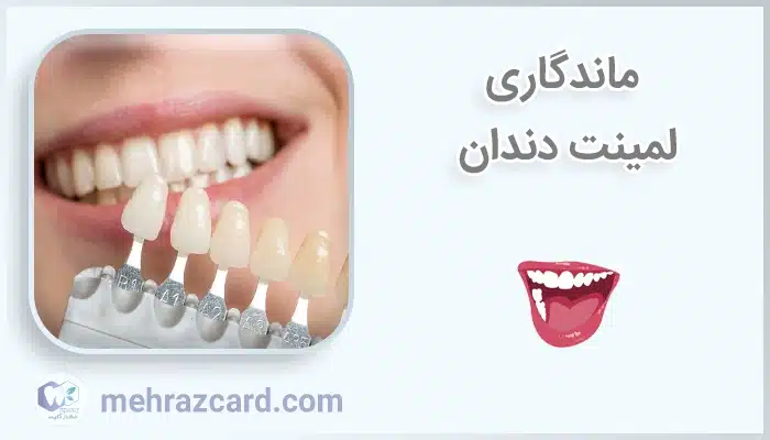 ماندگاری لمینت دندان
