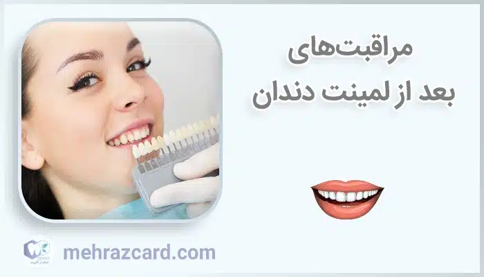 مراقبت‌های بعد از لمینت دندان