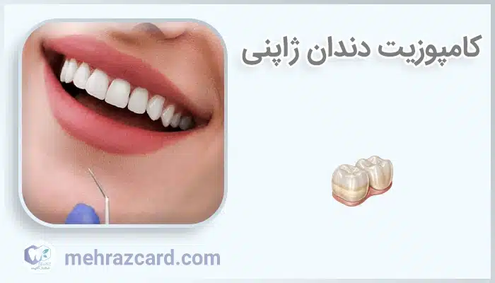 کامپوزیت دندان ژاپنی