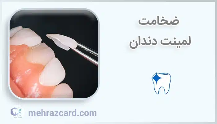 ضخامت لمینت دندان