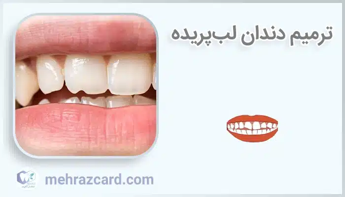 ترمیم دندان لب‌پریده