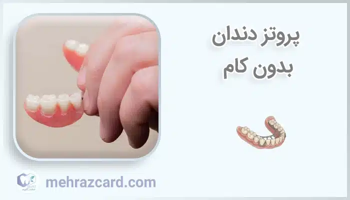 پروتز دندان بدون کام