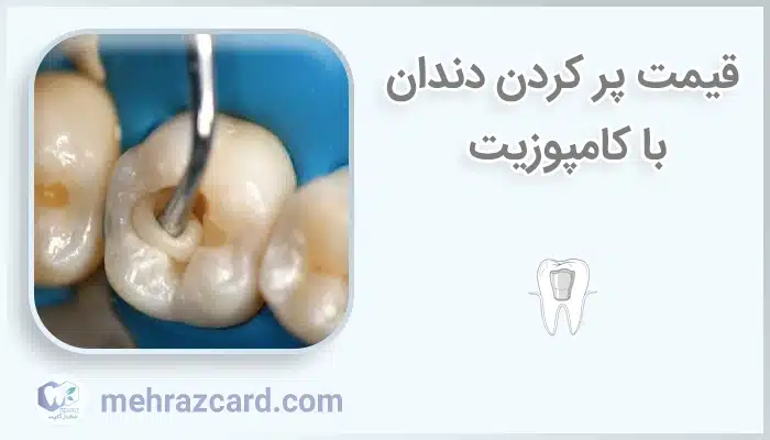 قیمت پر کردن دندان با کامپوزیت